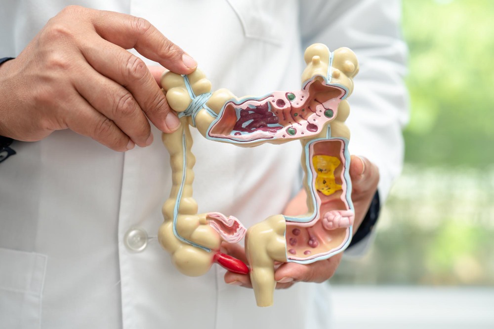 Alteração do Hábito Intestinal - Dra. Thaís Figueiredo
